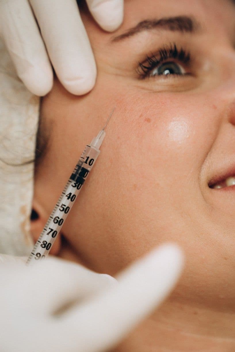 Botox behandlinger