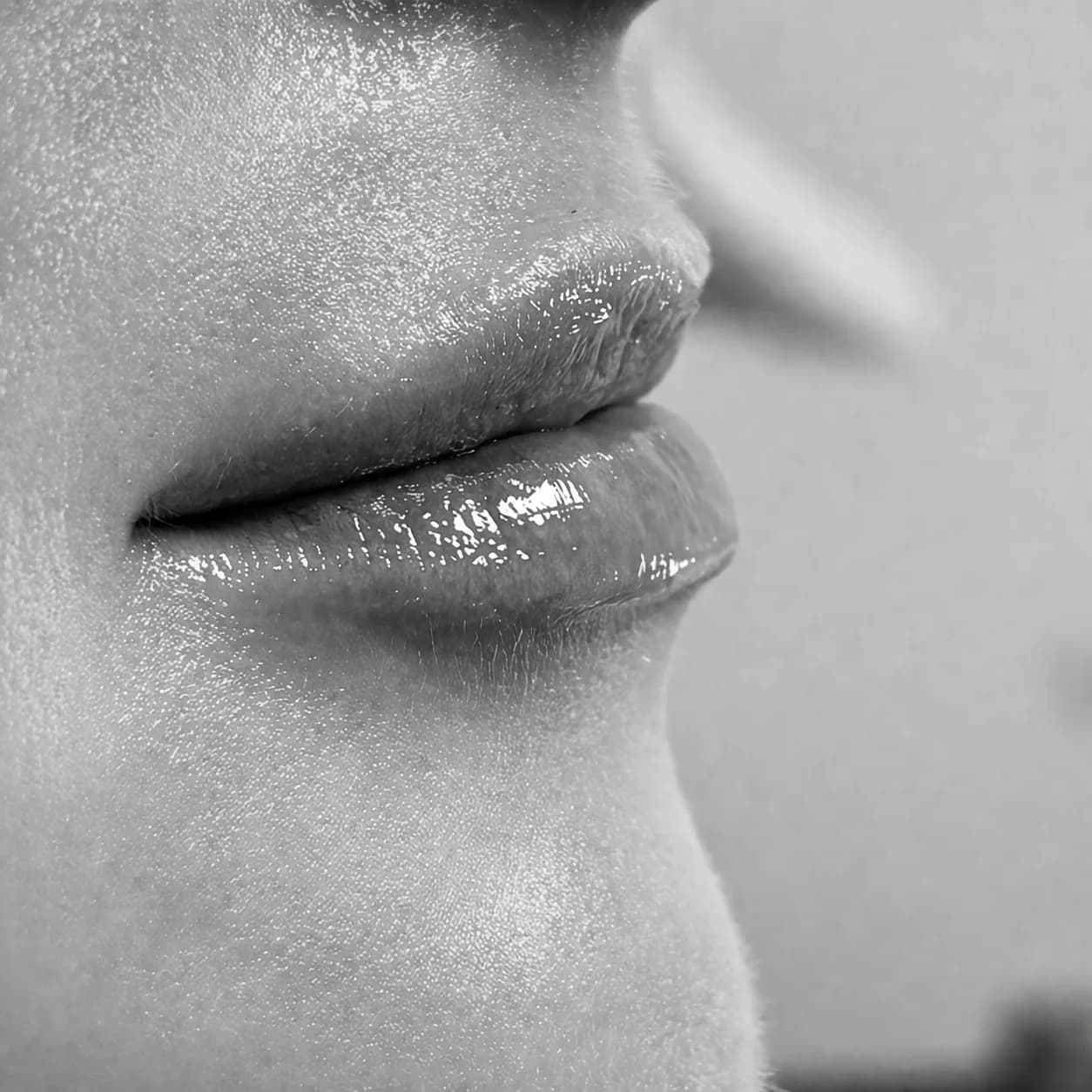 Fillers